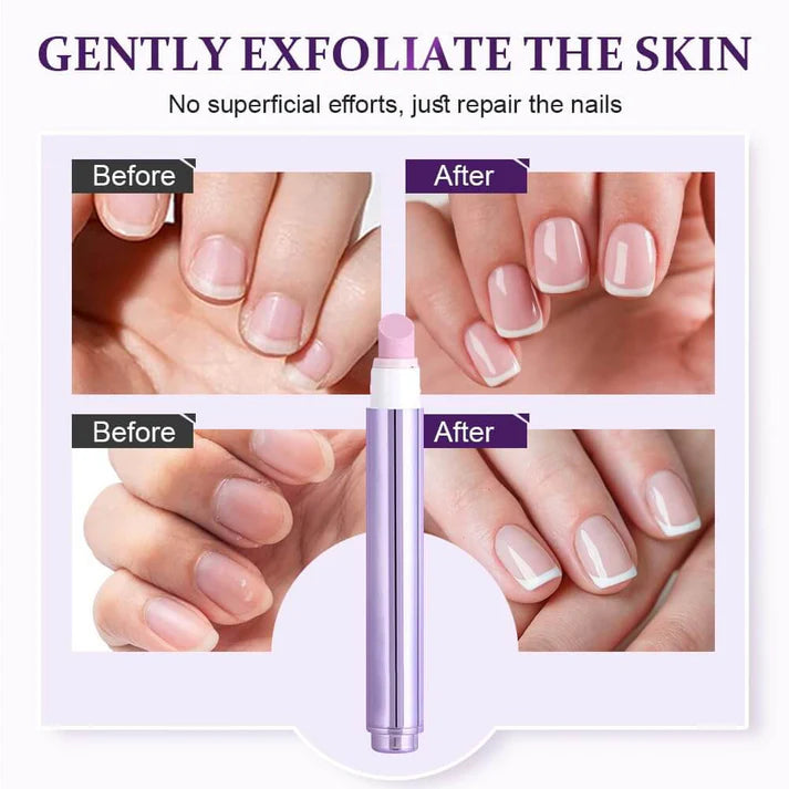 Ceramic Pocket Cuticle Remover